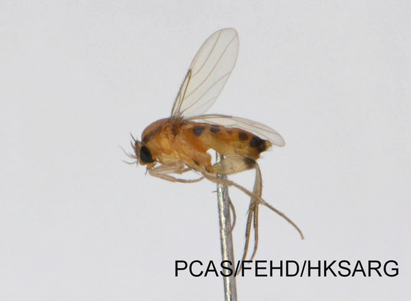 lateral view 側面圖